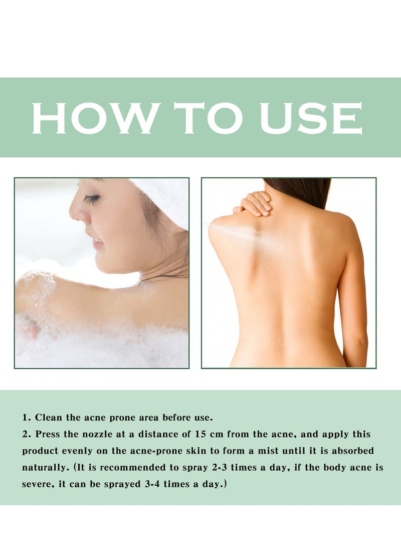 EELHOE Body Acne Cleansing Spray Deep Cleansing Back Arms Downplaying Acne Marks Beauty Moisturising Spray 120ML - Image 5