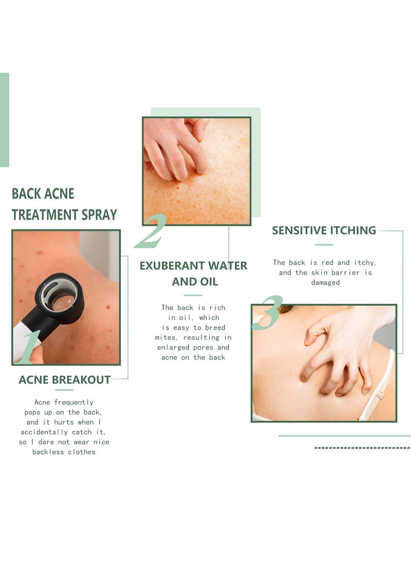 EELHOE Body Acne Cleansing Spray Deep Cleansing Back Arms Downplaying Acne Marks Beauty Moisturising Spray 120ML - Image 2