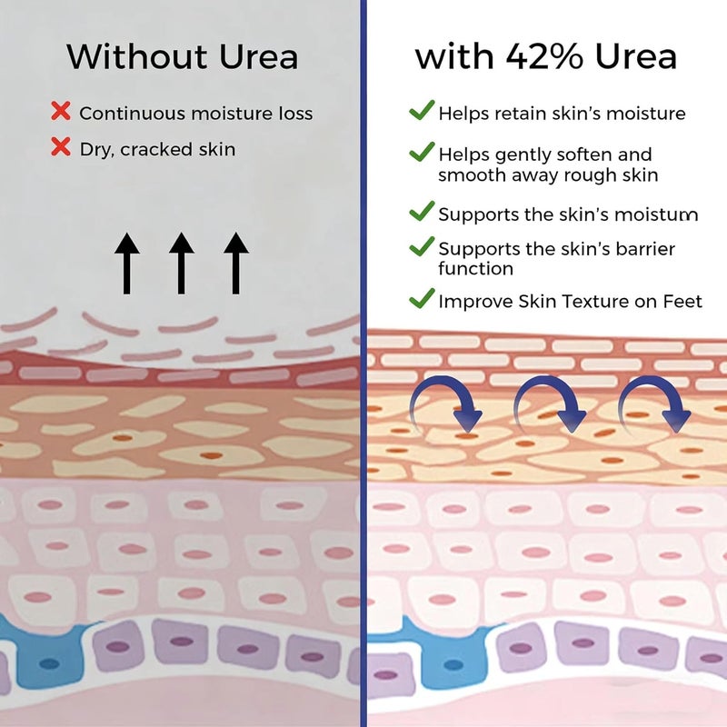 OUKEYA Urea Cream 42% plus Salicylic Acid 2% Intensive Moisturizer for Extremely Dry Chapped, Softens Rough Skin on Hands, Feet, Elbows & Knees, Removes Corns, Calluses, Dead Skin - Image 5