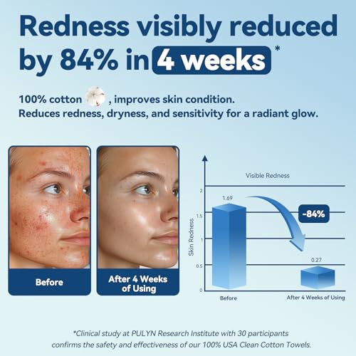 Winner Softer Face Towels - 100% USA Cotton Dry Wipes, 300 Count Unscented Cotton Tissues for Sensitive Skin, OEKO-TEX Certified Face Towelettes Disposable, Makeup Remover Facial Towels, 3 Pack - Image 2