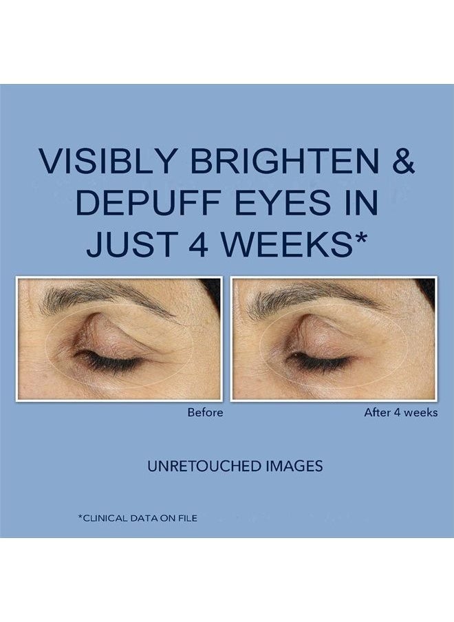 RoC - Retinol Correxion Under Eye Cream for Dark Circles & Puffiness, Daily Wrinkle Cream, Anti Aging Line Smoothing Skin Care Treatment 0.5 oz (Packaging May Vary) - Image 1