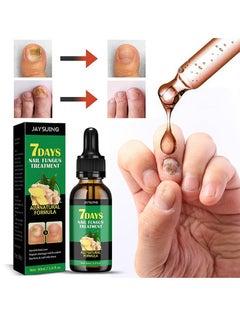 Jaysuing 7 DAYS Nail Fungus Treatment,Ginger Nail Treatment Nail Support Nail Care, , Ginger Nail Growth Serum, Ginger Cuticle Care Oil for Nails 30ml  - Image 1