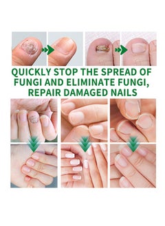 Jaysuing 7 DAYS Nail Fungus Treatment,Ginger Nail Treatment Nail Support Nail Care, , Ginger Nail Growth Serum, Ginger Cuticle Care Oil for Nails 30ml  - Image 5