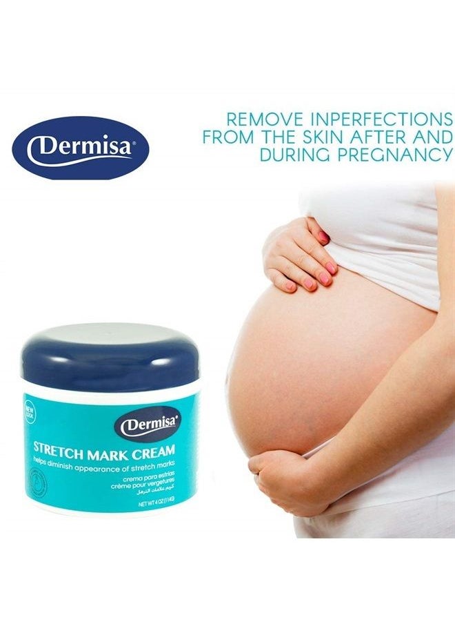 DERMISA - Stretch Mark Cream | With Cocoa Butter, Vitamin E, Collagen & Elastin | 4 OZ | Pack of 2 - Image 1