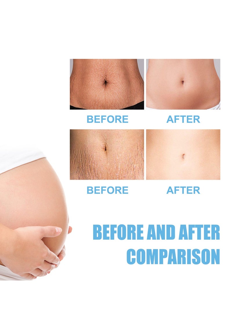 إيلهو كريم تدليك بروتين نيوروببتيد يبهت الندبات وعلامات الحمل كريم تدليك ناعم للبشرة - Image 2