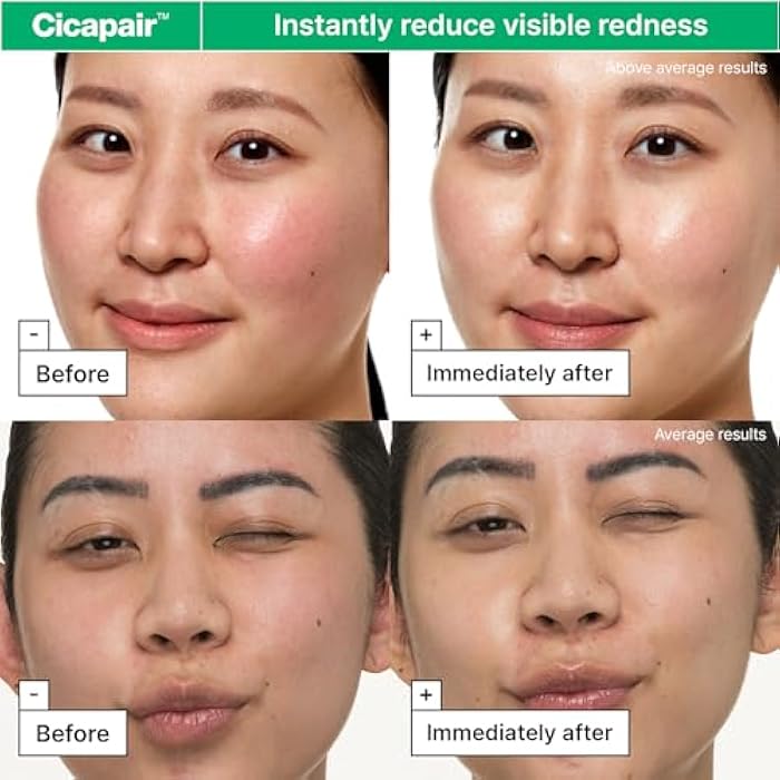 Dr.Jart+ Cicapair Sensitive Skin Korean Face Moisturizer for Redness and Barrier Repair with Centella Asiatica | Korean Skin Care - Image 3