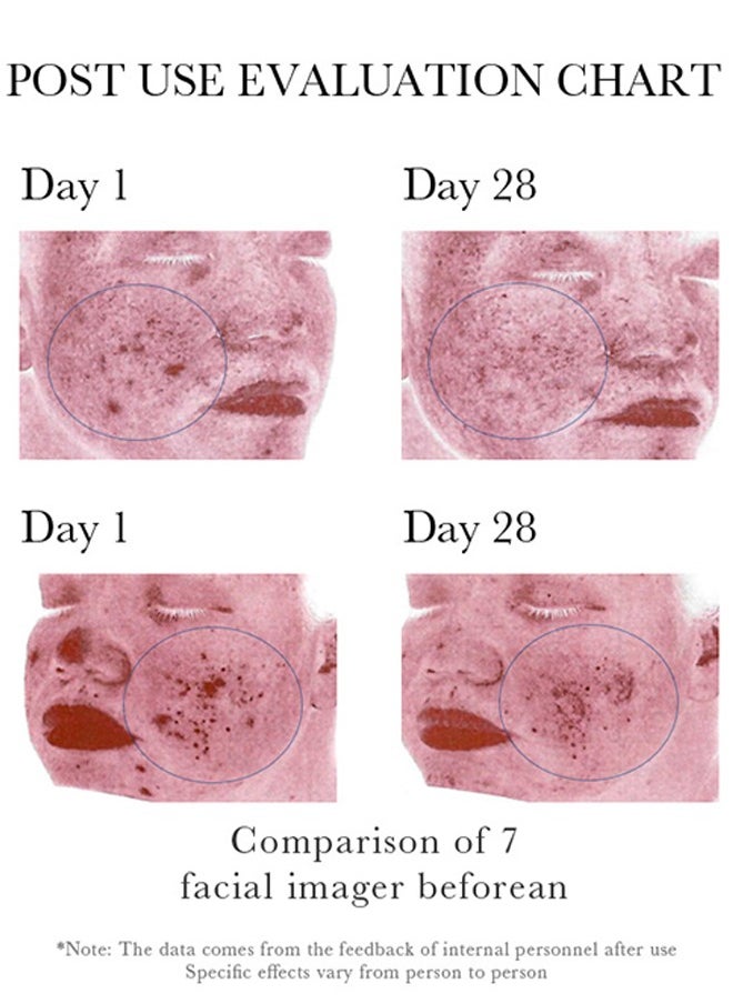 BIOAQUA - Salicylic Acid Acne Removal Cleanser - Deep Foam Cleanser Shrink Pores Soothing Oil Control 100g - Image 1