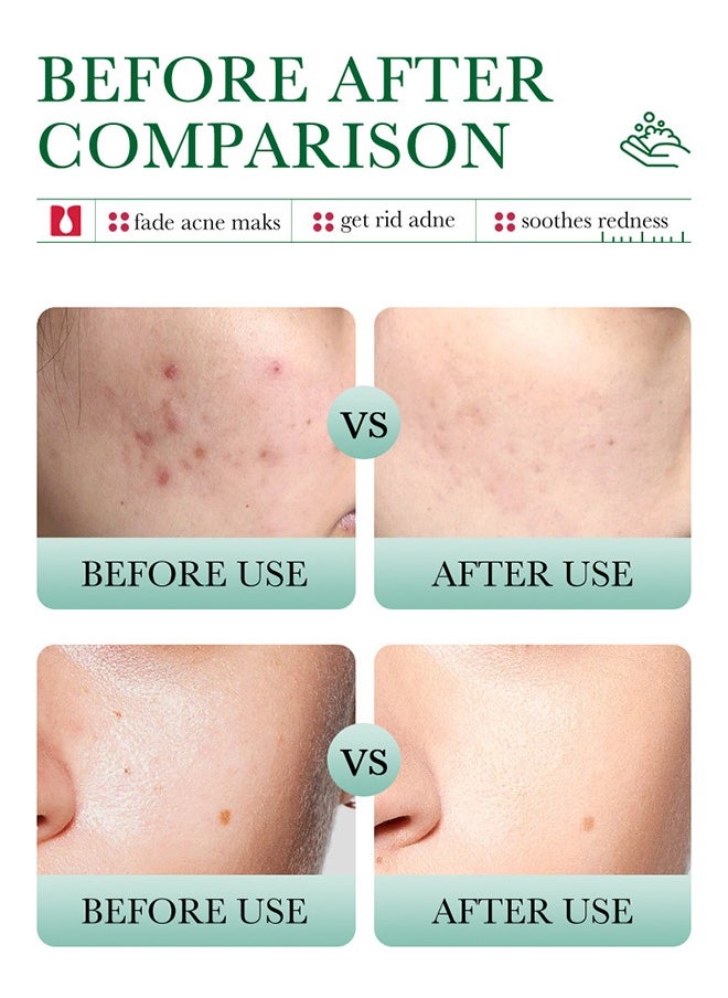 BIOAQUA - Salicylic Acid Acne Removal Cleanser - Deep Foam Cleanser Shrink Pores Soothing Oil Control 100g - Image 1