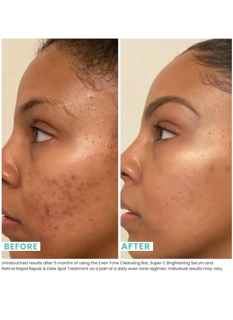 Urban Skin Rx Urban Skin Rx Even Tone Cleansing Bar | 3-in-1 Daily Cleanser, Exfoliator, and Brightening Mask Helps Diminish Uneven Skin Tone, Formulated with Kojic Acid, Azelaic Acid, and Niacinamide | 3.7 Oz  - Image 3