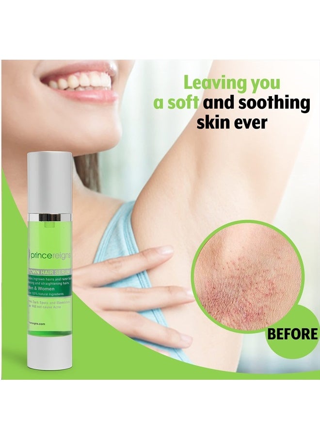 Princereigns - Shaving Gel - Banish Ingrown Hair and Razor Bumps for Smooth, Nourished Skin - 100% Organic Solution for Irritation-Free Skin - Perfect for Both Men and Women - Ideal for Face, Neck, Biki - Image 1