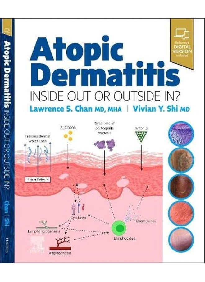 Atopic Dermatitis: Inside Out or Outside in 