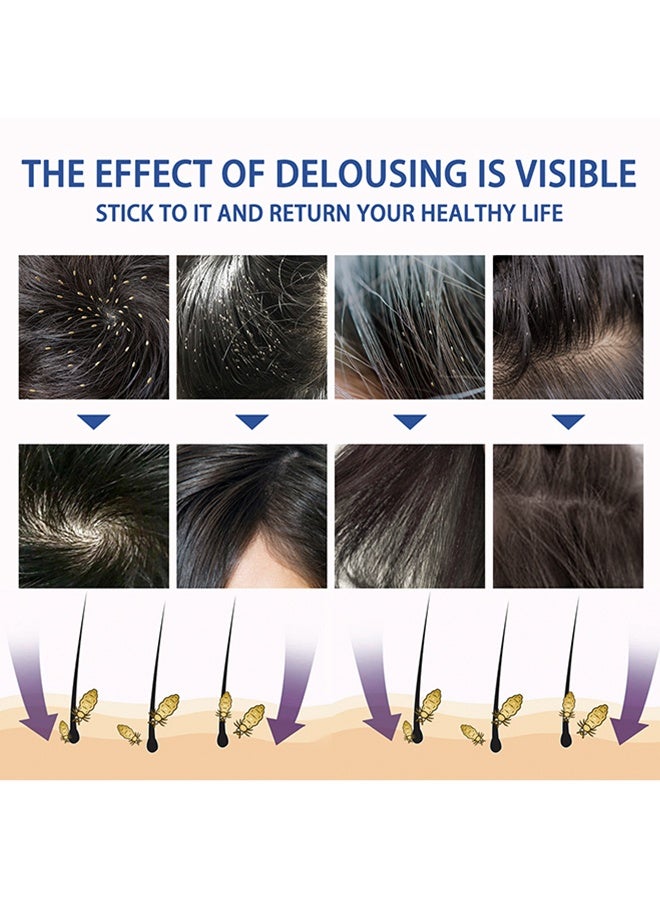 SOUTH MOON Scabies Lice Spray - For Kids & Adults, Easy Use Lice Spray Kills Head Lice, Eggs, Super Lice on Contact, Includes Metal Lice Comb, Multiple Treatments, 30ml - Image 5