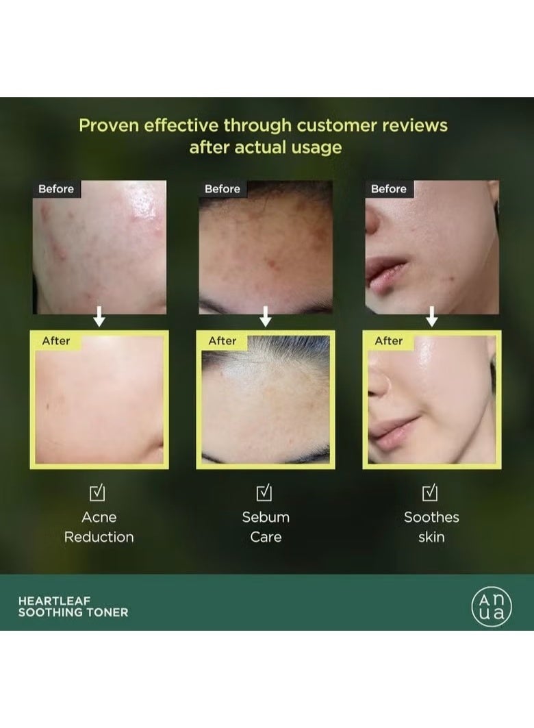 Anua Wonder Heartleaf 77% Soothing Toner 250ML + 10% Niacinamide + 4% Tranexamic Acid Serum 30ML - Image 3