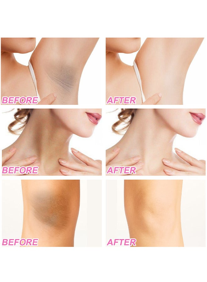 EELHOE Whitening Cream - Dark Spot Corrector For Face And Body - Underarm Cream - Brighten And Moisturizes For Armpit Neck Knees - Body White Remove Melanin 100G - Image 5