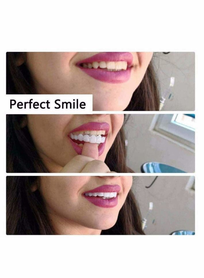 Generic 2 Pairs Instant Veneers Dentures Cosmetic Veneers Teeth Temporary Dentures Fake Teeth Smile Teeth Veneers Top and Bottom Snap On Dentures Clip in Veneers Teeth for Men Women with Bad Teeth  - Image 5