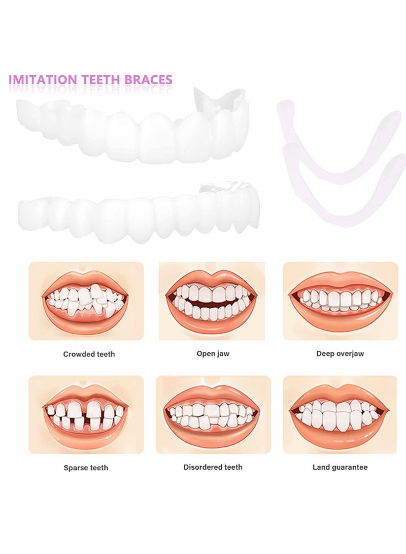 Generic 2 Pairs Instant Veneers Dentures Cosmetic Veneers Teeth Temporary Dentures Fake Teeth Smile Teeth Veneers Top and Bottom Snap On Dentures Clip in Veneers Teeth for Men Women with Bad Teeth  - Image 4