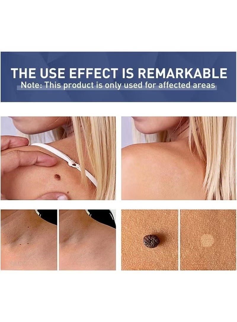 Lanthome Wart Remover, Fast Acting and Painless Skin Tag Remover Liquid, Tags and Mole Remover, Tag-Remover for Hands and Body, Wart Cream for Genital Warts, Plantar Wart, Common Wart, Corn, Flat Wart - Image 5