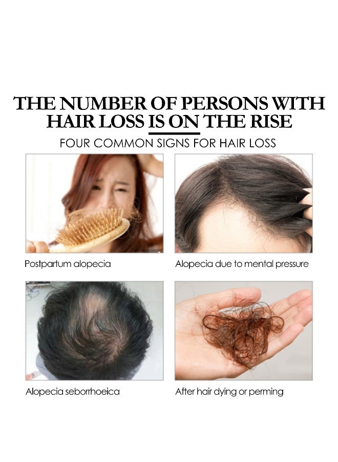 EELHOE Batana Oil for Hair Growth  Batana Oil - Batana Oil Organic for Healthy Hair - Repair Damaged Hair, Nourishes Thin Hair Scalp Skin and Loss Hair Growth Fir for All Hair Types - 30 ml - Image 3