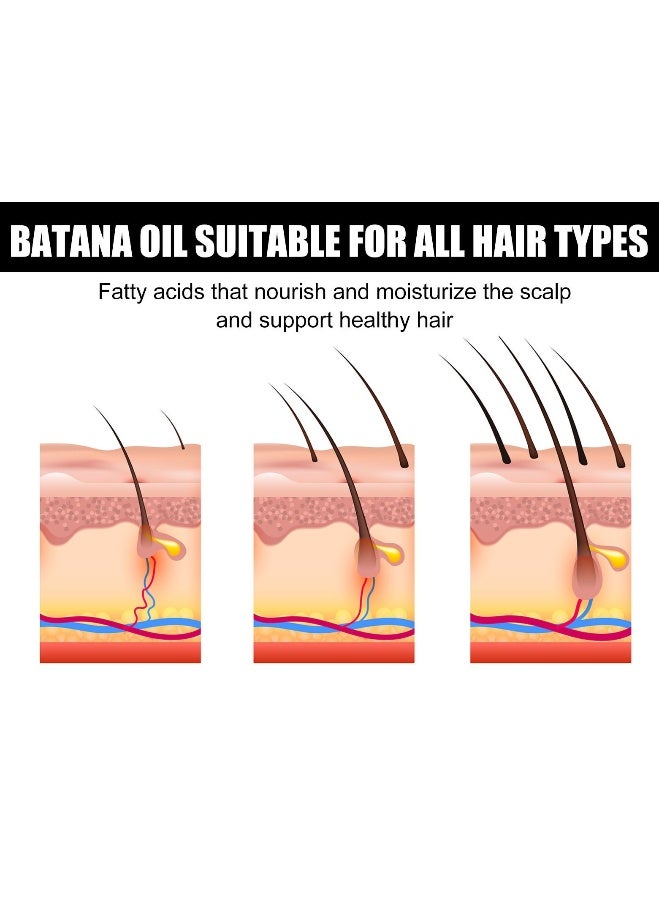 EELHOE Batana Oil for Hair Growth  Batana Oil - Batana Oil Organic for Healthy Hair - Repair Damaged Hair, Nourishes Thin Hair Scalp Skin and Loss Hair Growth Fir for All Hair Types - 30 ml - Image 5