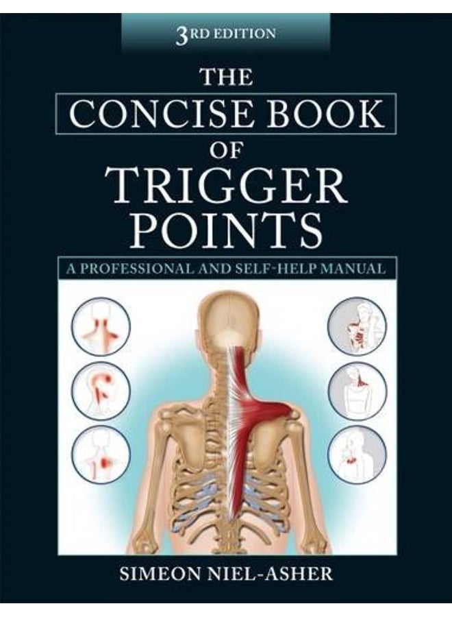 The Concise Book of Trigger Points  - Image 1