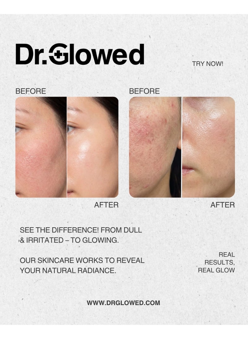 الدكتور غلويد Dr. Glowed كريم لُونار التجديدي 50 مل مع PDRN (DNA السلمون) وإكسوسومات السنتيلا والسيراميدات لإصلاح حاجز البشرة وترطيب الوجه - Image 4