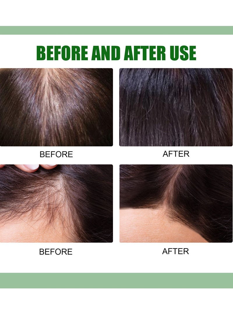 EELHOE - Ginger Hair growth spray, Rapid Growth Hair Treatment 7 Day Hair Growth Serum Essence Oil Regrow, Ginger Essential Oil Stop Hair Loss Hair, Thinning Treatment Hair Growth Oil for Women & Men 20ML - Image 1