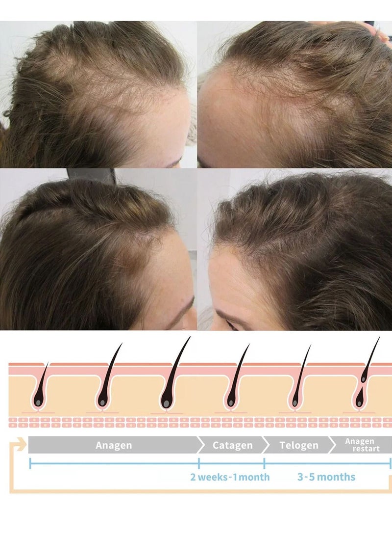 EELHOE - Ginger Hair growth spray, Rapid Growth Hair Treatment 7 Day Hair Growth Serum Essence Oil Regrow, Ginger Essential Oil Stop Hair Loss Hair, Thinning Treatment Hair Growth Oil for Women & Men 20ML - Image 1