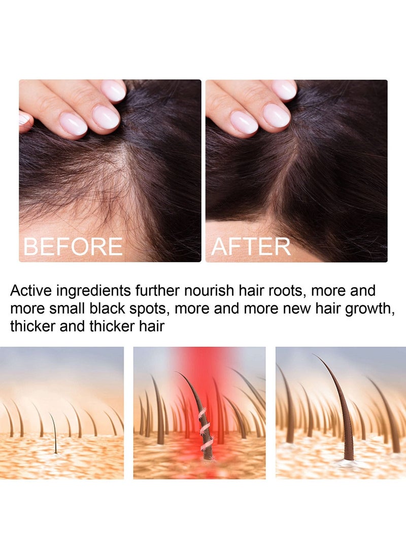 EELHOE - Ginger Hair growth spray, Rapid Growth Hair Treatment 7 Day Hair Growth Serum Essence Oil Regrow, Ginger Essential Oil Stop Hair Loss Hair, Thinning Treatment Hair Growth Oil for Women & Men 20ML - Image 1
