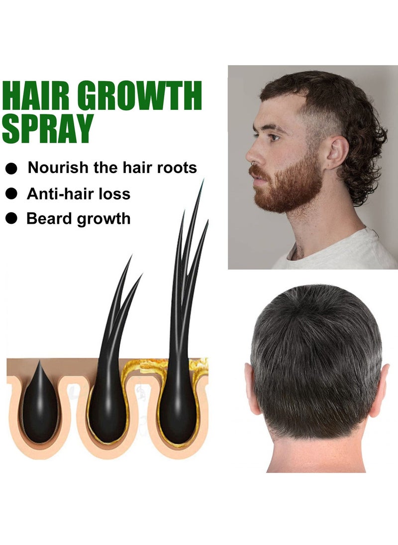EELHOE - Ginger Hair growth spray, Rapid Growth Hair Treatment 7 Day Hair Growth Serum Essence Oil Regrow, Ginger Essential Oil Stop Hair Loss Hair, Thinning Treatment Hair Growth Oil for Women & Men 20ML - Image 1