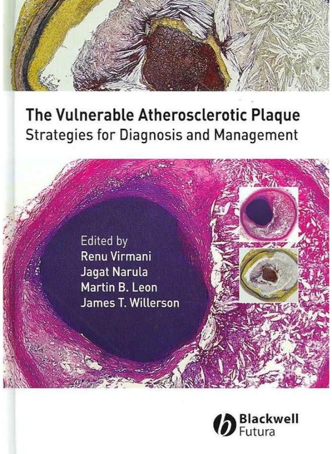 The Vulnerable Atherosclerotic Plaque: Strategies for Diagnosis and Management