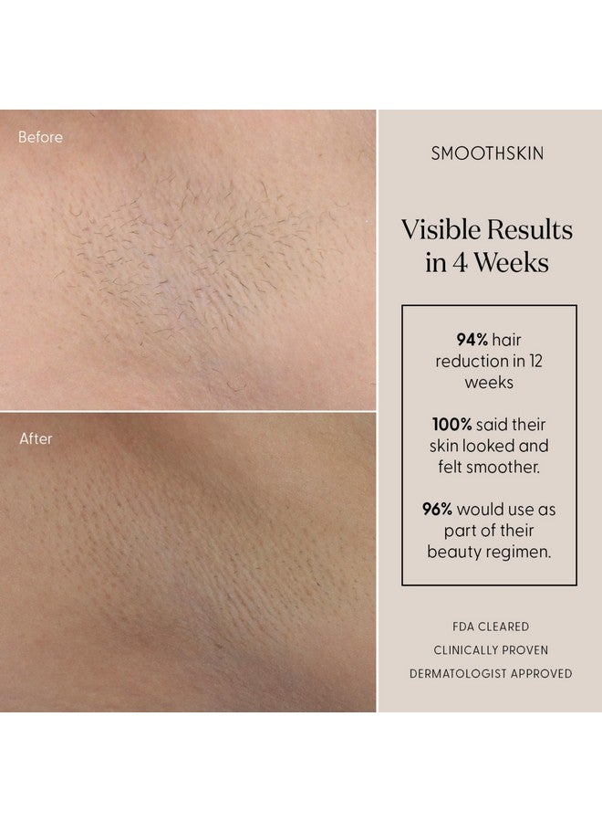 SmoothSkin Pure Mini IPL Laser Hair Removal Device, Long-Lasting, for Body & Facial Hair Removal, Alternative to Laser Hair Removal, Bikini Shaver & Epilator, with Precision Head for Small Areas - Image 4