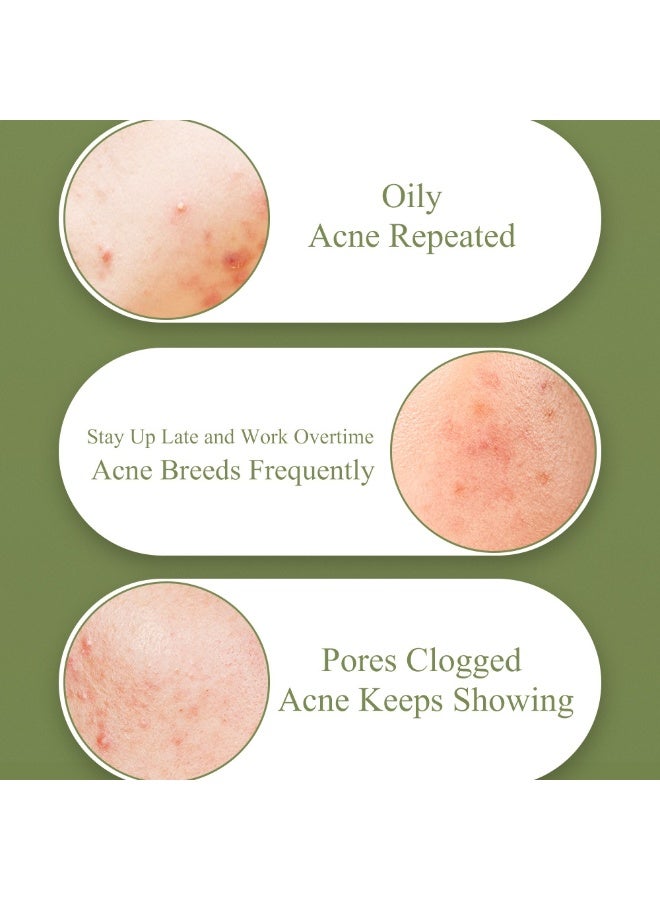 Breylee 2-PACKS Tea Tree Oil Acne Treatment Gel, Acne-prone Skin Care Gel, Emergency Repair Gel 15g*2 - Image 3