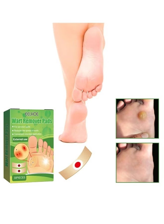 EELHOE 30 Pcs Wart Removal Pads, Treatment Relief Corn Pain and Foot Care, Clean Anti-Itting and Antibacterial Patches - Image 2
