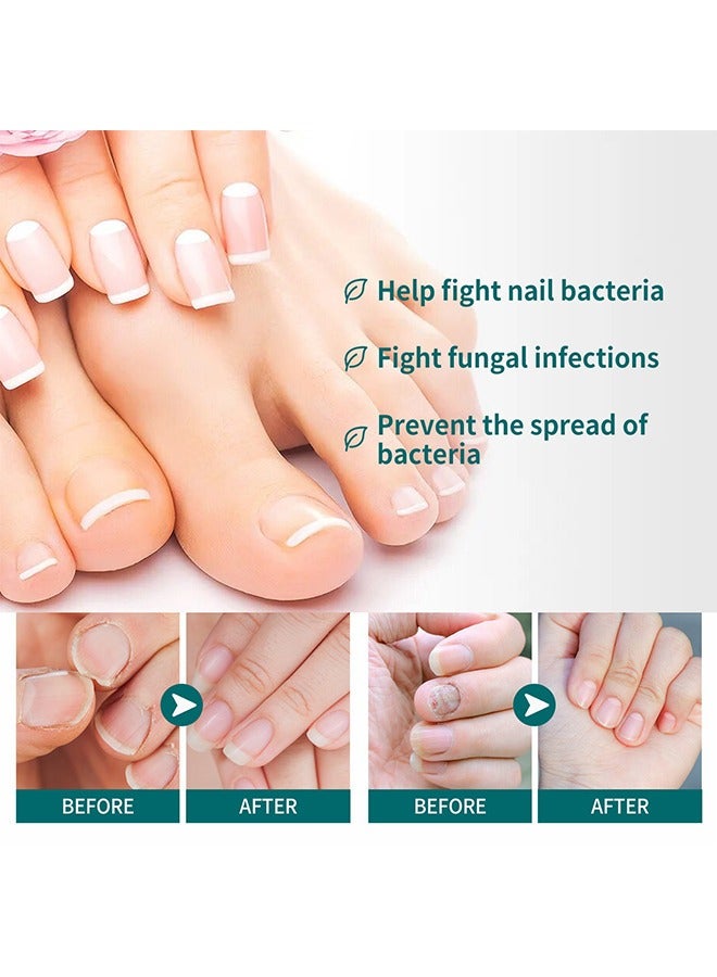 SOUTH MOON Toenail Fungus Treatment Extra Strength-Fungal Nail Treatment for Toe Nail and Fingernails-Nail Repair Solution for Thick/Broken/Discolored Nails-Renews Damaged Cracked Ingrown Toenail - Image 4