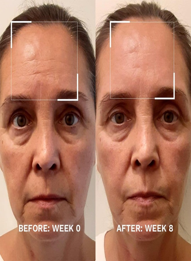 City Beauty Skin-Lifting Booster - Anti-Aging Booster Serum for Face - Lift & Tighten - Sagging Skin Solution with Peptides - Visibly Smooth Fine Lines & Wrinkles - Cruelty-Free, Clean Skin Care - Image 2