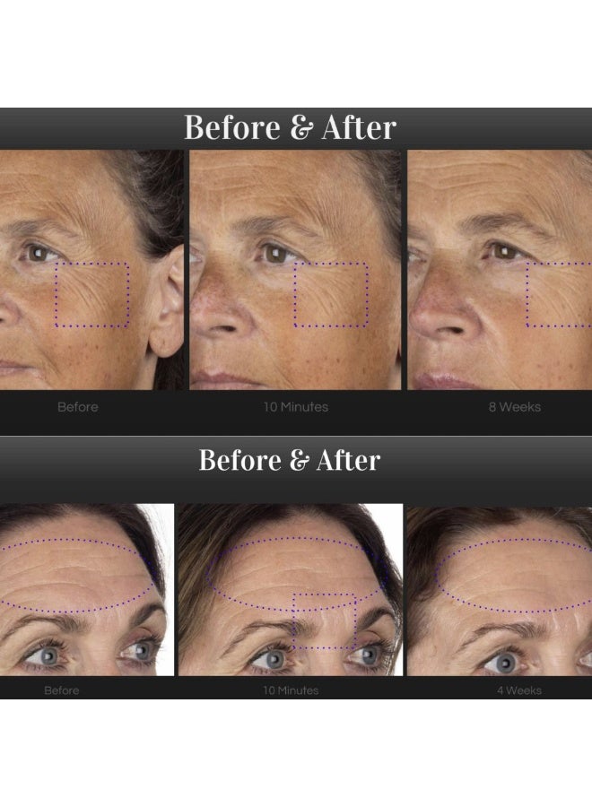 ميديك8 مصل Medik8 Liquid Peptides Advanced MP لتقليل التجاعيد 30 مل - Image 2