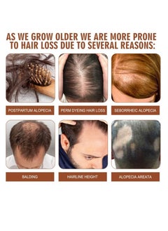EELHOE Batana Oil for Hair Growth Healthier Thicker Fuller Hair, Batana oil, Batana Oil for Hair Growth, Batana Oil Organic, Batana Oil Organic for Healthy Hair, Batana Oil Hair Mask (1PCS)  - Image 5