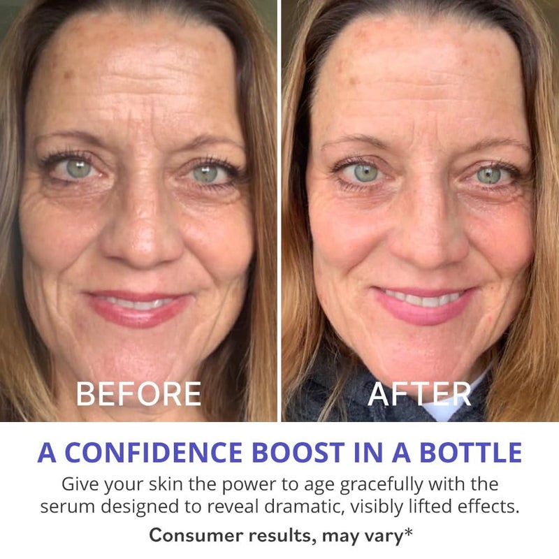 goPure Actives Firm & Lift Serum - Anti-Aging Serum with Retinol for more Smooth, Even-Texture and Glowing Skin, and Antioxidant Bakuchiol for Collagen Support and Firmer-Looking Skin - 1 fl oz - Image 4