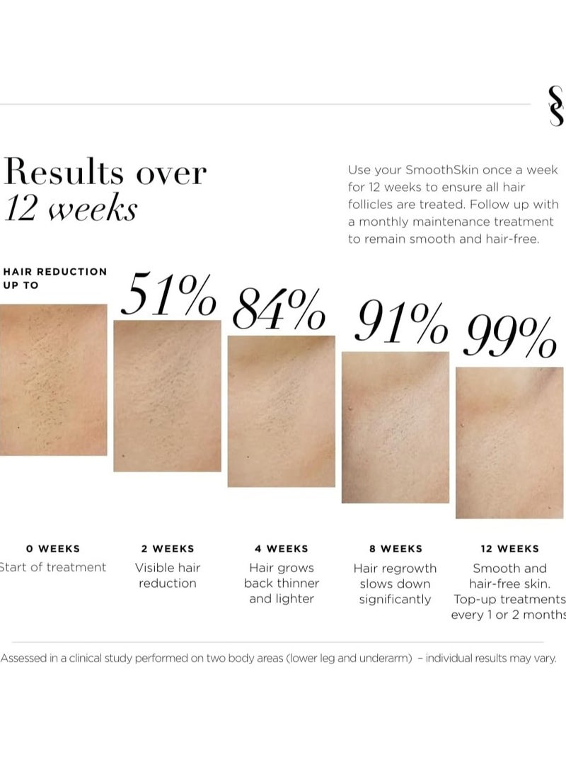 Smoothskin - Pure Mini Lite Lilac IPL Laser Hair Removal Device, Long-Lasting Body, Bikini, Facial Hair Removal, Alternative to Laser & Bikini Shaver, Clinically Tested and FDA Cleared - pzsku/Z97542F5059281027F3A1Z/45/_/1736272537/d0a38c62-c289-437b-82d9-e6c7b11f7802