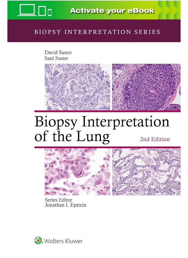 Biopsy Interpretation of the Lung 