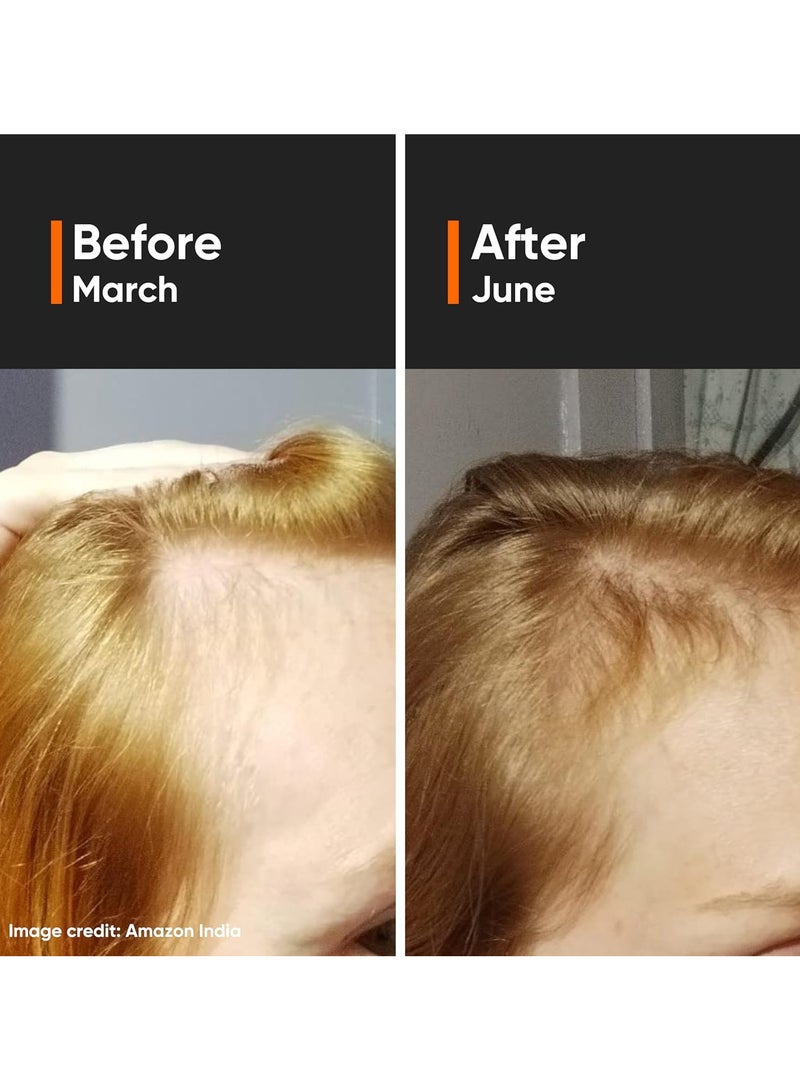 منيماليست سيروم لنمو الشعر يحتوي على 3٪ ريدينسيل و3٪ بروكابيل و5٪ كابيكسيل يقلل من تساقط الشعر ويعزز نموه 30 مل - Image 2