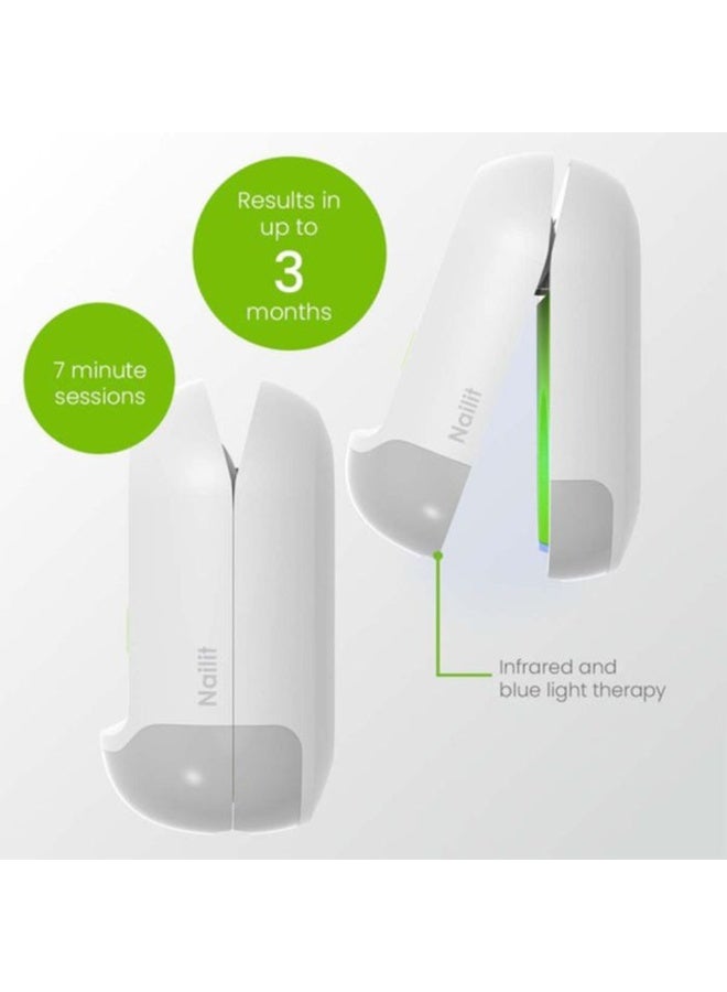 TensCare Nailit Fungal Nail Cleaner Laser Device – Dual-Action Infrared & Blue Light Therapy for Healthier Nails – Pain-Free, Drug-Free 7-Minute Daily Treatment – USB Rechargeable - Image 5