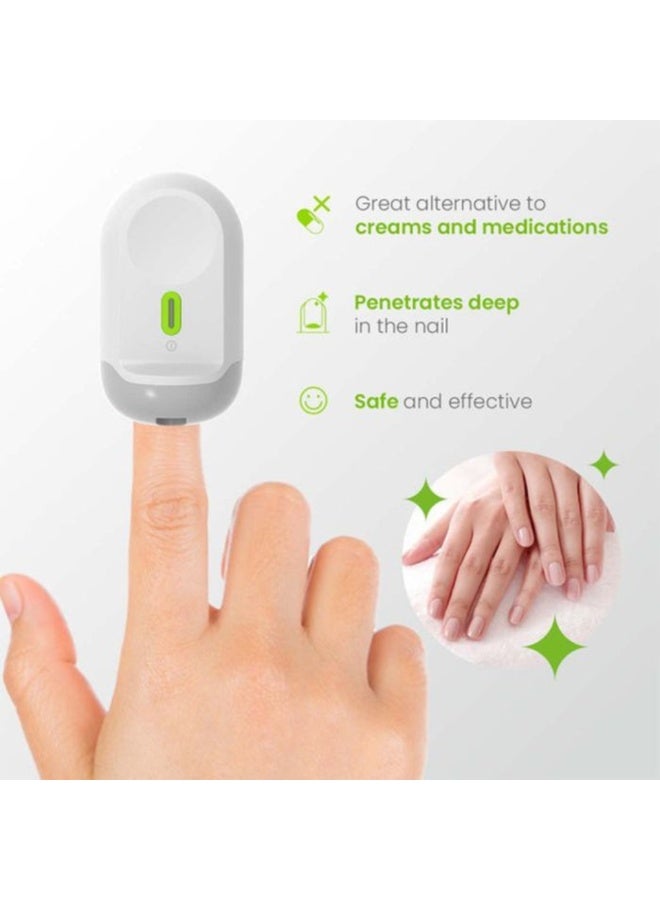 TensCare Nailit Fungal Nail Cleaner Laser Device – Dual-Action Infrared & Blue Light Therapy for Healthier Nails – Pain-Free, Drug-Free 7-Minute Daily Treatment – USB Rechargeable - Image 2