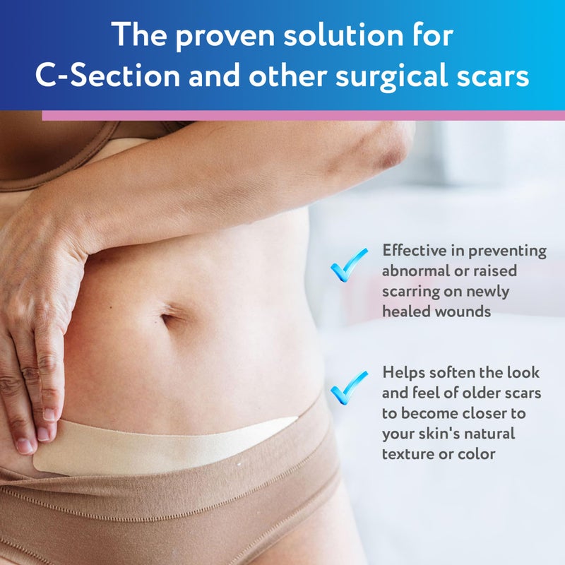 ScarAway Advanced Silicone Scar Sheets for C-Section, Reusable Strips (1.5â€ x 7â€) for Hypertrophic and Keloid Scars from C-Section & Other Surgeries, 4 Sheets - Image 2