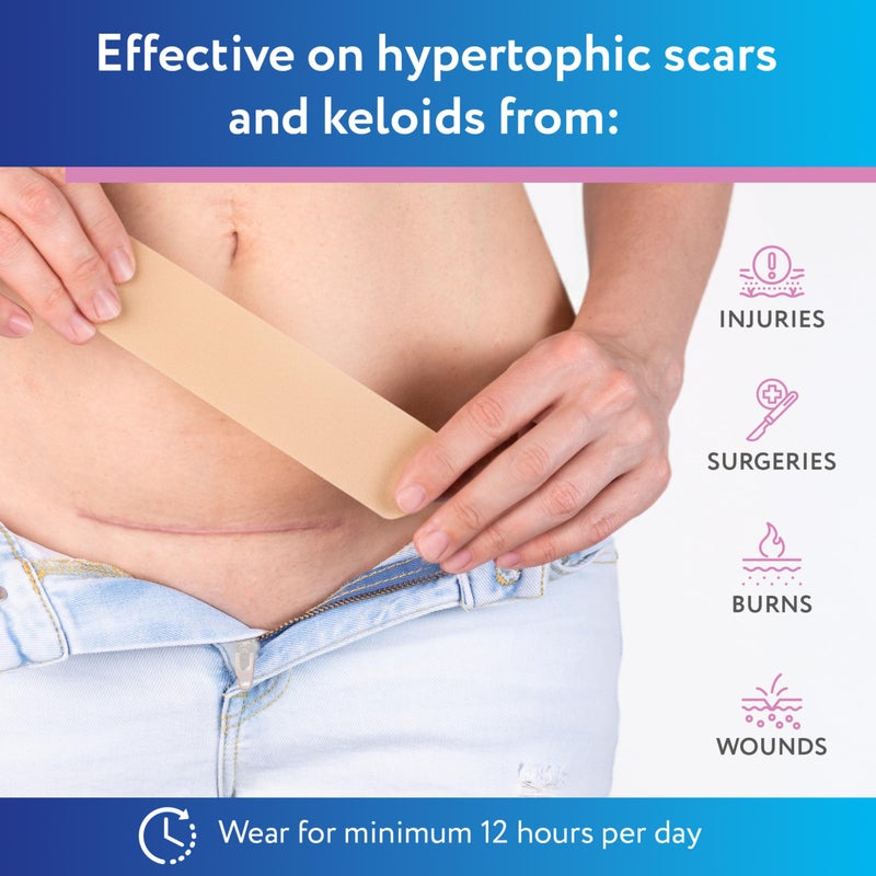 ScarAway Advanced Silicone Scar Sheets for C-Section, Reusable Strips (1.5â€ x 7â€) for Hypertrophic and Keloid Scars from C-Section & Other Surgeries, 4 Sheets - Image 4