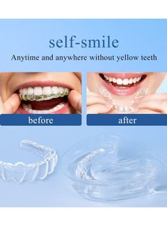 Siruini Portable denture cleaning liquid,99% sterilisation and deodorisation disposable denture retainer,brace special cleaning liquid  - Image 4