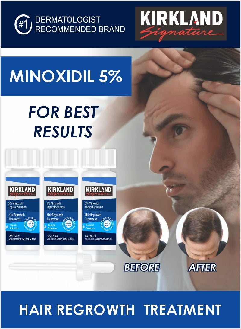 Kirkland Signature Minoxidil 5% Scalp Solution – 3-Month Pack for Effective Hair Regrowth  - Image 2
