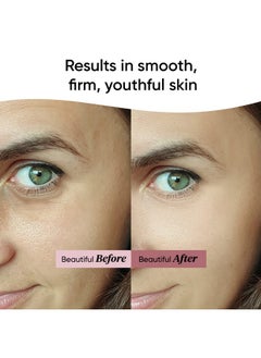 Dot & Key Night Reset Retinol + Ceramide Night Cream | Anti Aging Cream For Women & Men | Reduces Fine Lines & Wrinkles | Oil Free & Non Sticky Moisturizer | For Glowing Youthful Skin | For All Skin Types | 25Ml  - Image 3