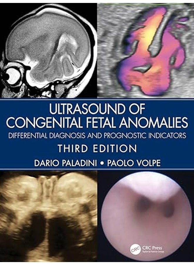 Ultrasound Of Congenital Fetal Anomalies Differential Diagnosis And Prognostic Indicators
