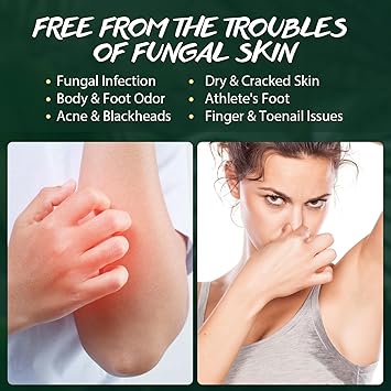 POP MODERN.C Tea Tree Body Wash Tea Tree Shower Gel with Peppermint Oil and Coconut Oil Improve Skin Fungus Skin Itchy Jock Itch Athletes Foot Eczema Body Odor Shower Gel with Pump for Men Women 300ml - Image 4